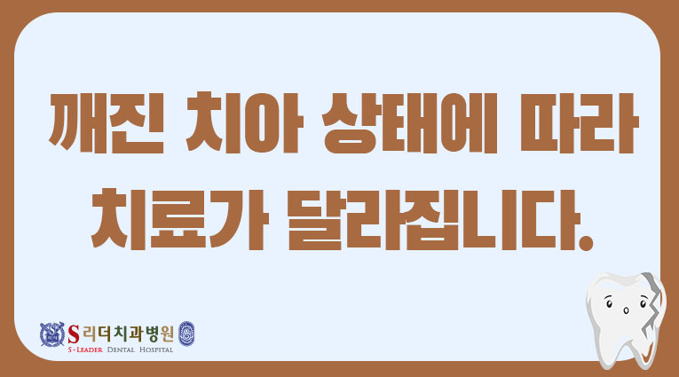 치아 파절, 깨진 정도가 중요합니다