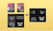 picture3 orthodontic_process3